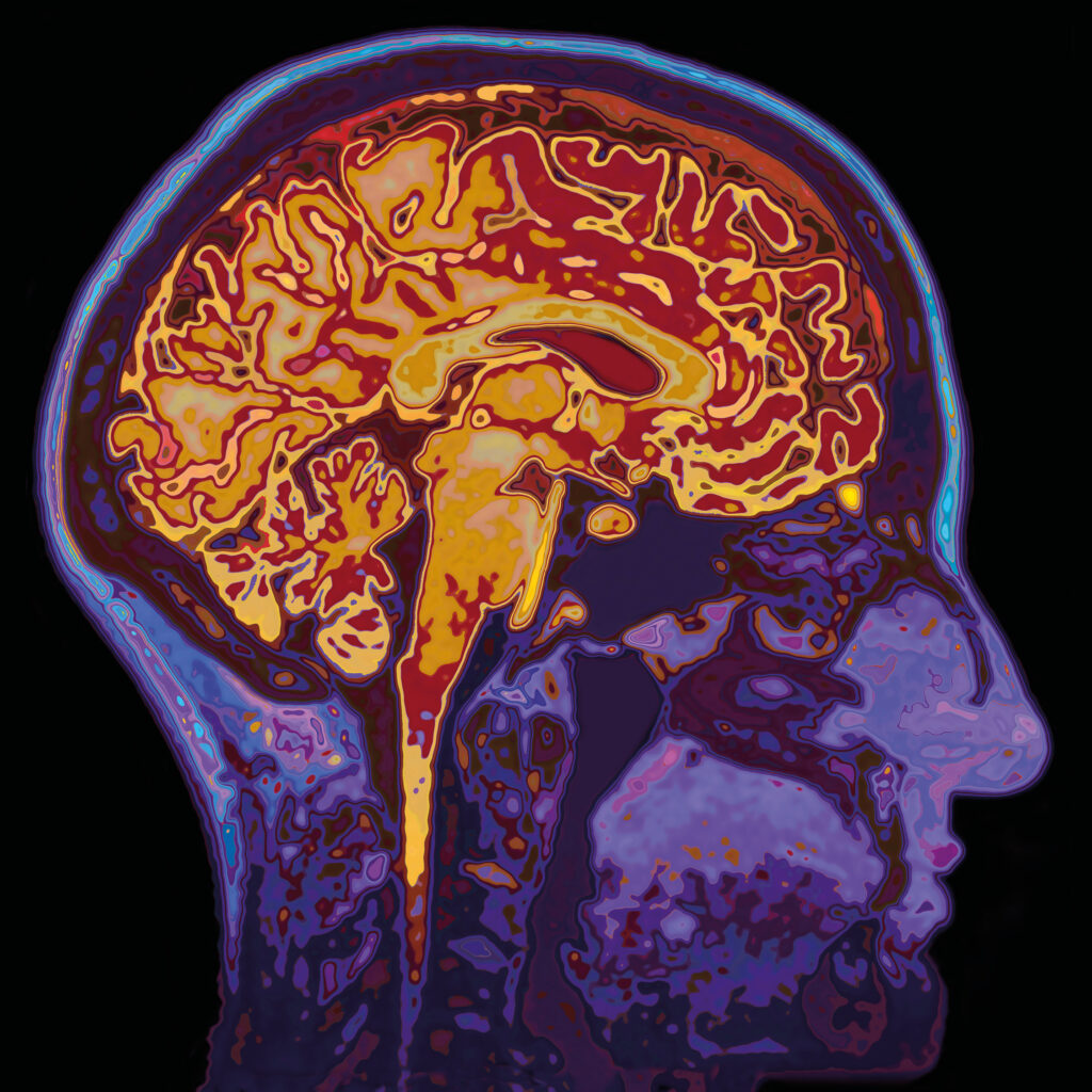 effetto cerebrale (shutterstock 344282432)