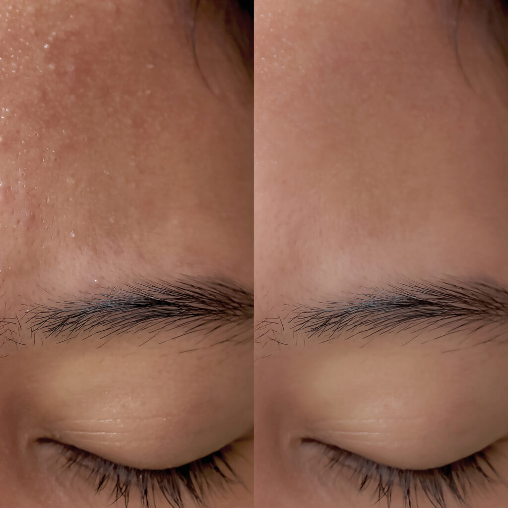 skin (shutterstock 1430370626)